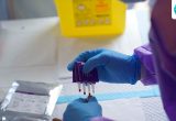 Kenya confirms second Ebola death as cases rise to nine